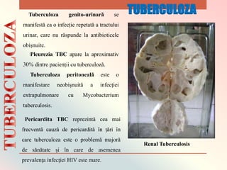 Renal Tuberculosis
Tuberculoza genito-urinarǎ se
manifestǎ ca o infecție repetatǎ a tractului
urinar, care nu rǎspunde la antibioticele
obișnuite.
Pleurezia TBC apare la aproximativ
30% dintre pacienții cu tuberculozǎ.
Tuberculoza peritonealǎ este o
manifestare neobișnuitǎ a infecției
extrapulmonare cu Mycobacterium
tuberculosis.
Pericardita TBC reprezintǎ cea mai
frecventǎ cauzǎ de pericarditǎ ȋn țǎri ȋn
care tuberculoza este o problemǎ majorǎ
de sǎnǎtate și ȋn care de asemenea
prevalența infecției HIV este mare.
TUBERCULOZA
 