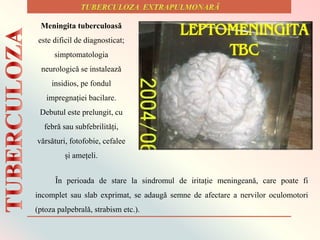 Meningita tuberculoasǎ
este dificil de diagnosticat;
simptomatologia
neurologicǎ se instaleazǎ
insidios, pe fondul
impregnației bacilare.
Debutul este prelungit, cu
febrǎ sau subfebrilitǎți,
vǎrsǎturi, fotofobie, cefalee
și amețeli.
Ȋn perioada de stare la sindromul de iritație meningeanǎ, care poate fi
incomplet sau slab exprimat, se adaugǎ semne de afectare a nervilor oculomotori
(ptoza palpebralǎ, strabism etc.).
 