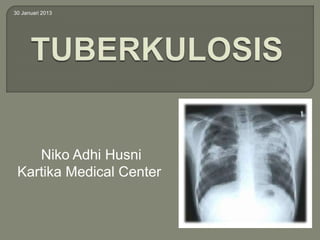 Niko Adhi Husni
Kartika Medical Center
30 Januari 2013
 