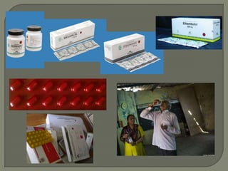 Tuberkulosis penyuluhan