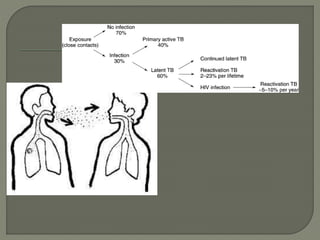 Tuberkulosis penyuluhan