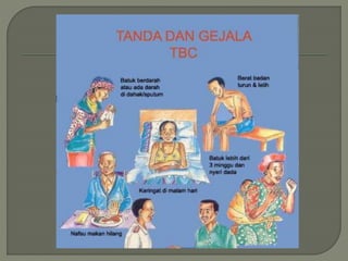 Tuberkulosis penyuluhan