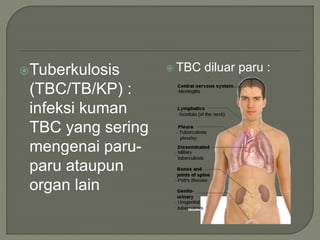 Tuberkulosis
(TBC/TB/KP) :
infeksi kuman
TBC yang sering
mengenai paru-
paru ataupun
organ lain
 TBC diluar paru :
 