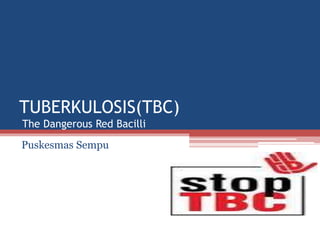 TUBERKULOSIS(TBC)
The Dangerous Red Bacilli
Puskesmas Sempu
 