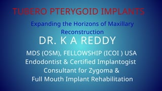 Tubero Instrument TUBERO PTERYGOID IMPLANTS | DR K A REDDY | LBR DENTAL | PPTX