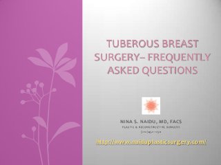 TUBEROUS BREAST
SURGERY– FREQUENTLY
ASKED QUESTIONS

NINA S. NAIDU, MD, FACS
PLASTIC & RECONSTRUCTIVE SURGERY

(212)452-1230

http://www.naiduplasticsurgery.com/

 