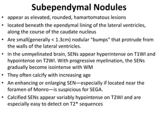 Subependymal Nodules
• appear as elevated, rounded, hamartomatous lesions
• located beneath the ependymal lining of the lateral ventricles,
along the course of the caudate nucleus
• Are small(generally < 1.3cm) nodular "bumps" that protrude from
the walls of the lateral ventricles.
• In the unmyelinated brain, SENs appear hyperintense on T1WI and
hypointense on T2WI. With progressive myelination, the SENs
gradually become isointense with WM
• They often calcify with increasing age
• An enhancing or enlarging SEN—especially if located near the
foramen of Monro—is suspicious for SEGA.
• Calcified SENs appear variably hypointense on T2WI and are
especially easy to detect on T2* sequences
 
