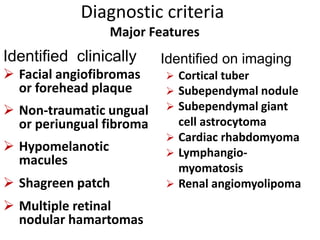 Diagnostic criteria
Major Features
Identified clinically
 Facial angiofibromas
or forehead plaque
 Non-traumatic ungual
or periungual fibroma
 Hypomelanotic
macules
 Shagreen patch
 Multiple retinal
nodular hamartomas
 Cortical tuber
 Subependymal nodule
 Subependymal giant
cell astrocytoma
 Cardiac rhabdomyoma
 Lymphangio-
myomatosis
 Renal angiomyolipoma
Identified on imaging
 