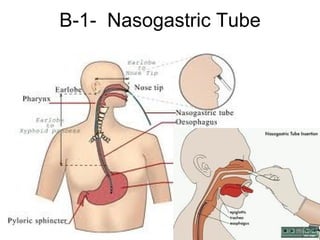 B-1-  Nasogastric Tube 
