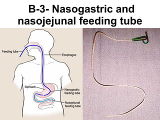   B-3- Nasogastric and nasojejunal feeding tube 