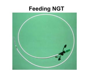 Feeding NGT 