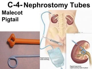 C-4-   Nephrostomy Tubes Malecot Pigtail   