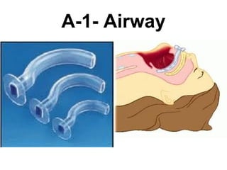 A-1- Airway 