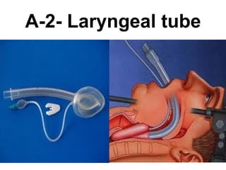 A-2- Laryngeal tube 
