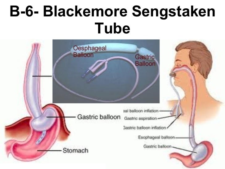 Surgery 6th year, Tutorial (Dr. AbdulWahid)