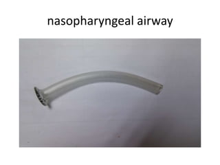 nasopharyngeal airway
 