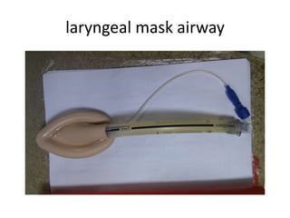 laryngeal mask airway
 