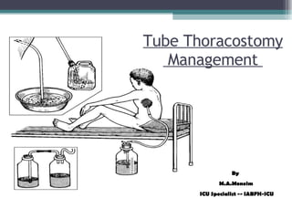 Tube Thoracostomy  Management  By  M.A.Moneim ICU Specialist -- IABFH-ICU 