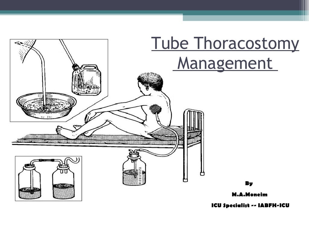 Tube Thoracostomy, Management