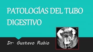 PATOLOGÍAS DEL TUBO
DIGESTIVO
Dr. Gustavo Rubio
 