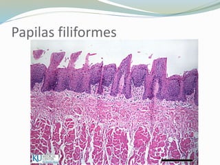 Papilas filiformes
 