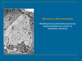 Microvilos ou Microvilosidades Modificações do plasmalema apical das células epiteliais que cobrem as vilosidades intestinais 