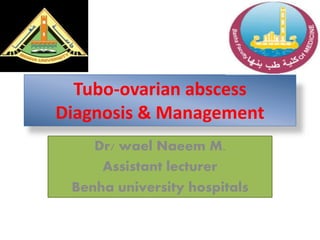 Tubo-ovarian abscess
Diagnosis & Management
Dr/ wael Naeem M.
Assistant lecturer
Benha university hospitals
 