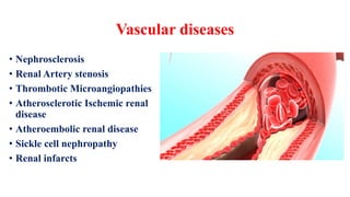 Tubulointerstitial diseases