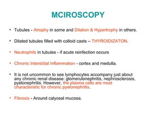 MCIROSCOPY
• Tubules - Atrophy in some and Dilation & Hypertrophy in others.
• Dilated tubules filled with colloid casts – THYROIDIZATON.
• Neutrophils in tubules - if acute reinfection occurs
• Chronic Interstitial Inflammation - cortex and medulla.
• It is not uncommon to see lymphocytes accompany just about
any chronic renal disease: glomerulonephritis, nephrosclerosis,
pyelonephritis. However, the plasma cells are most
characteristic for chronic pyelonephritis.
• Fibrosis - Around calyceal mucosa.
 