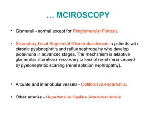 … MCIROSCOPY
• Glomeruli - normal except for Periglomerular Fibrosis.
• Secondary Focal Segmental Glomerulosclerosis in patients with
chronic pyelonephritis and reflux nephropathy who develop
proteinuria in advanced stages. The mechanism is adaptive
glomerular alterations secondary to loss of renal mass caused
by pyelonephritic scarring (renal ablation nephropathy).
• Arcuate and interlobular vessels - Obliterative endarteritis.
• Other arteries - Hypertensive Hyaline Arteriolosclerosis.
 