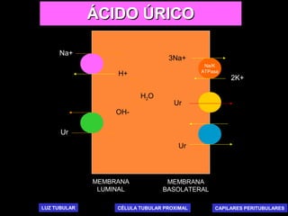 Na/K
ATPasa
MEMBRANA
LUMINAL
MEMBRANA
BASOLATERAL
3Na+
2K+
LUZ TUBULAR CAPILARES PERITUBULARESCÉLULA TUBULAR PROXIMAL
Ur
Ur
OH-
H+
A-
Na+
H2O
Ur
ÁCIDO ÚRICOÁCIDO ÚRICO
 