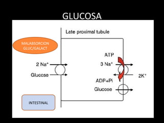 GLUCOSA
MALABSORCION
GLUC/GALACT
INTESTINAL
 