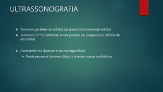 ULTRASSONOGRAFIA
 Tumores geralmente sólidos ou predominantemente sólidos
 Tumores hormonalmente ativos podem ser pequenos e difíceis de
encontrar
 Características diversas e pouco específicas
 Desde pequenos tumores sólidos a grandes massas multicísticas
 