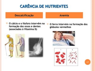 CCAARRÊÊNNCCIIAA DDEE NNUUTTRRIIEENNTTEESS 
DDeessccaallcciiffiiccaaççããoo AAnneemmiiaa 
 OO ccáállcciioo ee oo ffóóssffoorroo iinntteerrvvêêmm nnaa 
ffoorrmmaaççããoo ddooss oossssooss ee ddeenntteess 
((aassssoocciiaaddooss àà VViittaammiinnaa DD)) 
 OO ffeerrrroo iinntteerrvvéémm nnaa ffoorrmmaaççããoo ddooss 
ggllóóbbuullooss vveerrmmeellhhooss 
17 
 