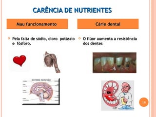CCAARRÊÊNNCCIIAA DDEE NNUUTTRRIIEENNTTEESS 
MMaauu ffuunncciioonnaammeennttoo CCáárriiee ddeennttaall 
 PPeellaa ffaallttaa ddee ssóóddiioo,, cclloorroo ppoottáássssiioo 
ee ffóóssffoorroo.. 
 OO ffllúúoorr aauummeennttaa aa rreessiissttêênncciiaa 
ddooss ddeenntteess 
18 
 