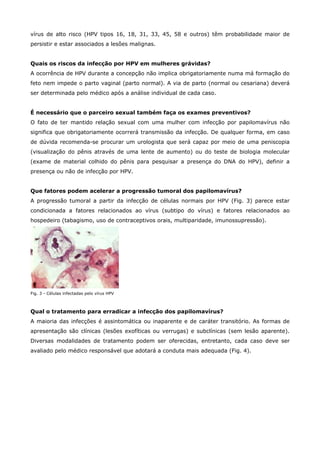 vírus de alto risco (HPV tipos 16, 18, 31, 33, 45, 58 e outros) têm probabilidade maior de
persistir e estar associados a lesões malignas.
Quais os riscos da infecção por HPV em mulheres grávidas?
A ocorrência de HPV durante a concepção não implica obrigatoriamente numa má formação do
feto nem impede o parto vaginal (parto normal). A via de parto (normal ou cesariana) deverá
ser determinada pelo médico após a análise individual de cada caso.
É necessário que o parceiro sexual também faça os exames preventivos?
O fato de ter mantido relação sexual com uma mulher com infecção por papilomavírus não
significa que obrigatoriamente ocorrerá transmissão da infecção. De qualquer forma, em caso
de dúvida recomenda-se procurar um urologista que será capaz por meio de uma peniscopia
(visualização do pênis através de uma lente de aumento) ou do teste de biologia molecular
(exame de material colhido do pênis para pesquisar a presença do DNA do HPV), definir a
presença ou não de infecção por HPV.
Que fatores podem acelerar a progressão tumoral dos papilomavírus?
A progressão tumoral a partir da infecção de células normais por HPV (Fig. 3) parece estar
condicionada a fatores relacionados ao vírus (subtipo do vírus) e fatores relacionados ao
hospedeiro (tabagismo, uso de contraceptivos orais, multiparidade, imunossupressão).

Fig. 3 - Células infectadas pelo vírus HPV

Qual o tratamento para erradicar a infecção dos papilomavírus?
A maioria das infecções é assintomática ou inaparente e de caráter transitório. As formas de
apresentação são clínicas (lesões exofíticas ou verrugas) e subclínicas (sem lesão aparente).
Diversas modalidades de tratamento podem ser oferecidas, entretanto, cada caso deve ser
avaliado pelo médico responsável que adotará a conduta mais adequada (Fig. 4).

 