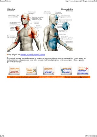 Arte G1
Veja imagens das manchas na pele e aspectos clínicos
É importante procurar orientação médica ao surgirem os primeiros sintomas, pois as manifestações iniciais podem ser
confundidas com outras doenças, como febre amarela, malária ou leptospirose e não servem para indicar o grau de
gravidade da doença.
Dengue Sintomas http://www.dengue.org.br/dengue_sintomas.html
2 of 2 05/04/2011 11:11
 
