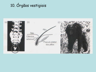 10. Órgãos vestigiais
 
