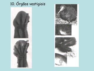 10. Órgãos vestigiais
 