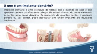 O que é um implante dentário?
Implante dentário é uma estrutura de titânio que é inserida no osso e que
aparece com um parafuso sem cabeça. Ele substitui a raiz do dente e é usado
sustentar uma coroa dentária. Dependendo de quantos dentes o paciente
perdeu ou vai perder, pode necessitar um único implante ou múltiplos
implantes.
Fotos: © Neodent Neodent Implantes Dentários
 