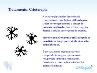 A criocirurgia também denominada
crioterapia ou crioablação é utilizada para
tratar por congelamento o câncer de
próstata localizado. Essa técnica congela e
destrói as células cancerígenas da próstata.
Esse método não é muito utilizado pois os
benefícios a longo prazo ainda não estão
bem definidos.
É um tratamento menos invasivo se
comparado à cirurgia e o processo de
recuperação também é mais rápido.
Entretanto, a crioterapia tem indicações
bastante limitadas.
Tratamento: Crioterapia
 