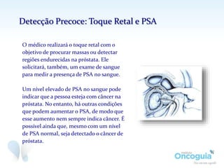 O médico realizará o toque retal com o
objetivo de procurar massas ou detectar
regiões endurecidas na próstata. Ele
solicitará, também, um exame de sangue
para medir a presença de PSA no sangue.
Um nível elevado de PSA no sangue pode
indicar que a pessoa esteja com câncer na
próstata. No entanto, há outras condições
que podem aumentar o PSA, de modo que
esse aumento nem sempre indica câncer. É
possível ainda que, mesmo com um nível
de PSA normal, seja detectado o câncer de
próstata.
Detecção Precoce: Toque Retal e PSA
 