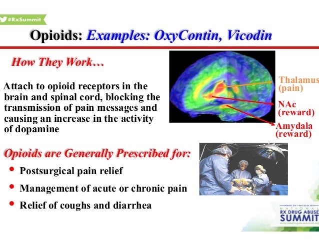 oxycodone and neurotransmitters
