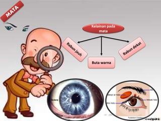 Kelainan pada
mata
Buta warna
 