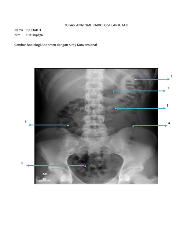 Tugas Anatomi Radiologi 3 | PDF