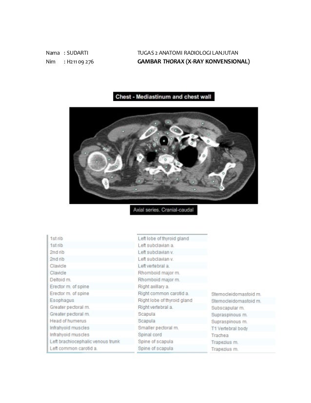 Tugas Anatomi Radiologi 2