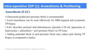 Prostate Block Transperineal Prostate Biopsy (TBP) Procedure.pptx
