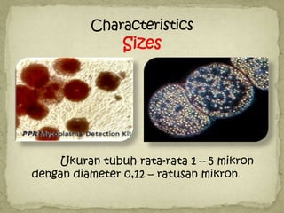 Ukuran tubuh rata-rata 1 – 5 mikron
dengan diameter 0,12 – ratusan mikron.
 