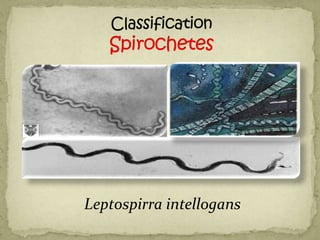 Leptospirra intellogans
 