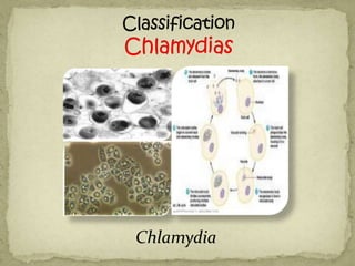 Chlamydia
 